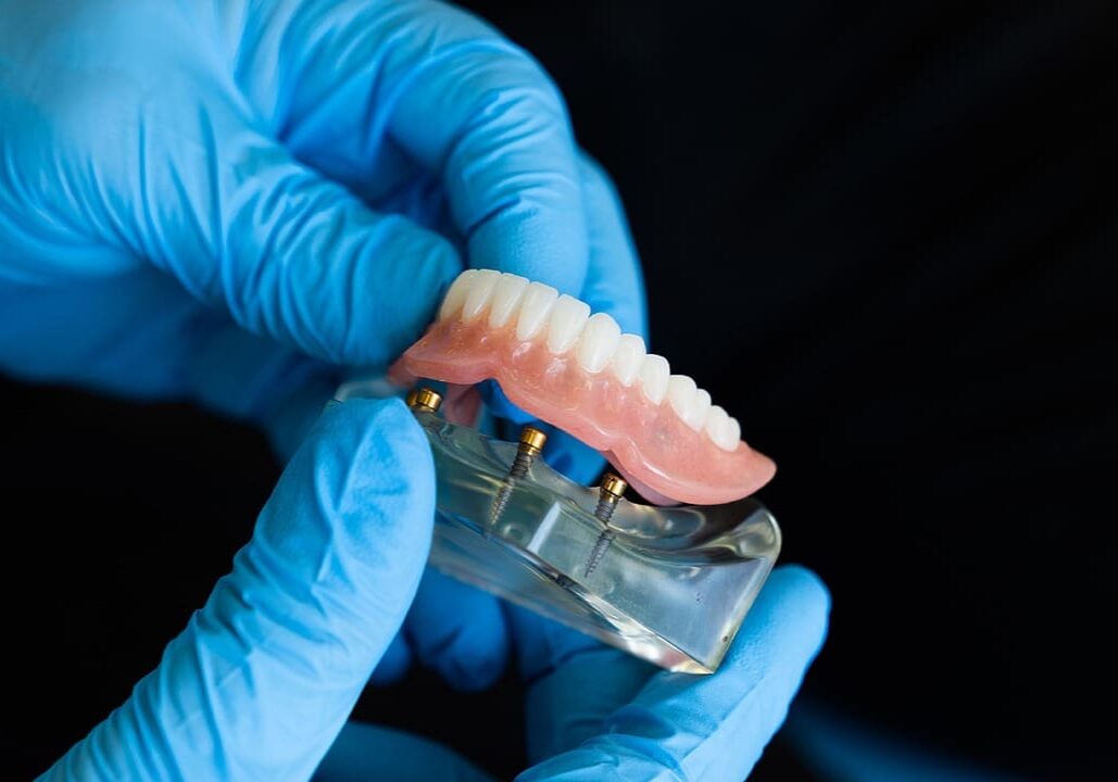 Dentures-dentist-6225094_1280