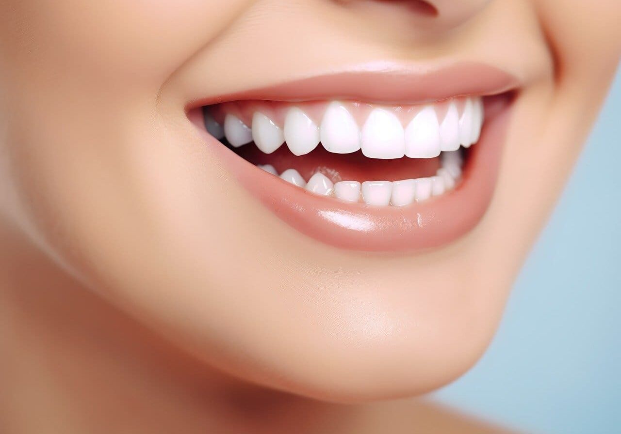 teeth whitening-model-woman-8383927_1280